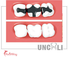 Slider image (3) Uncali Oral and Dental Clinic